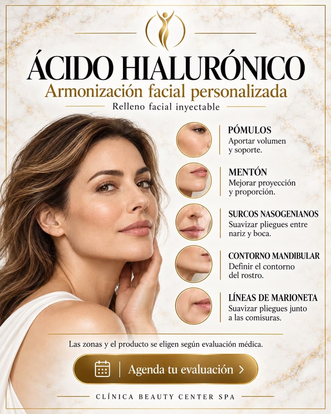Infografía Ácido hialurónico, armonización facial personalizada: pómulos, mentón, surcos nasogenianos, contorno mandibular y líneas de marioneta