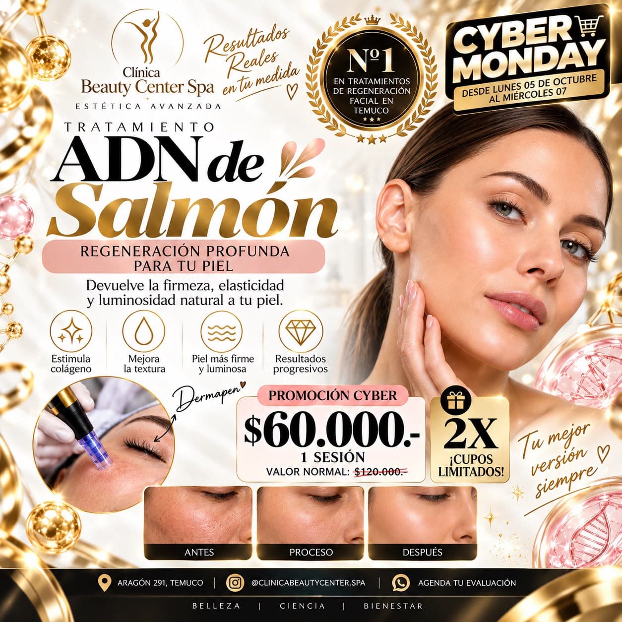 Promoción Cyber tratamiento ADN de salmón con dermapen a $60.000