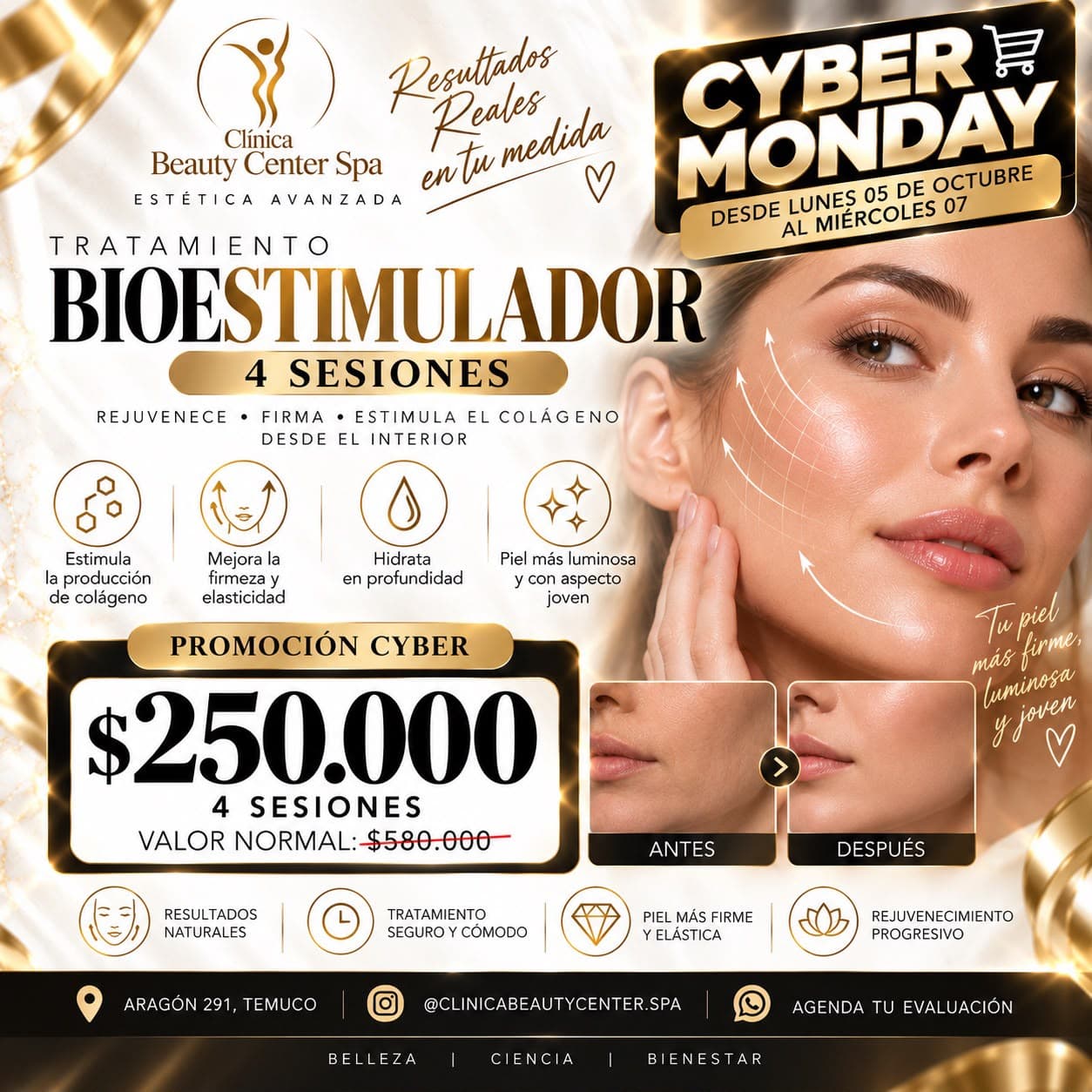 Promoción Cyber tratamiento bioestimulador 4 sesiones a $250.000