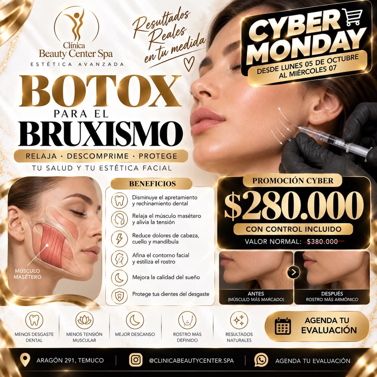 Promoción Cyber botox para el bruxismo con control incluido a $280.000
