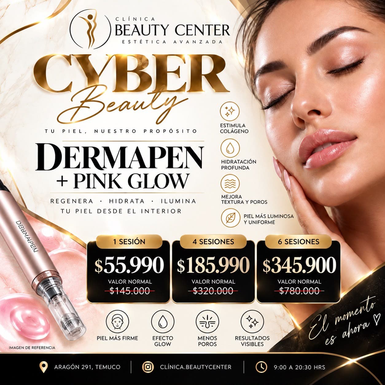 Promoción Cyber Beauty Dermapen más Pink Glow en 1, 4 o 6 sesiones