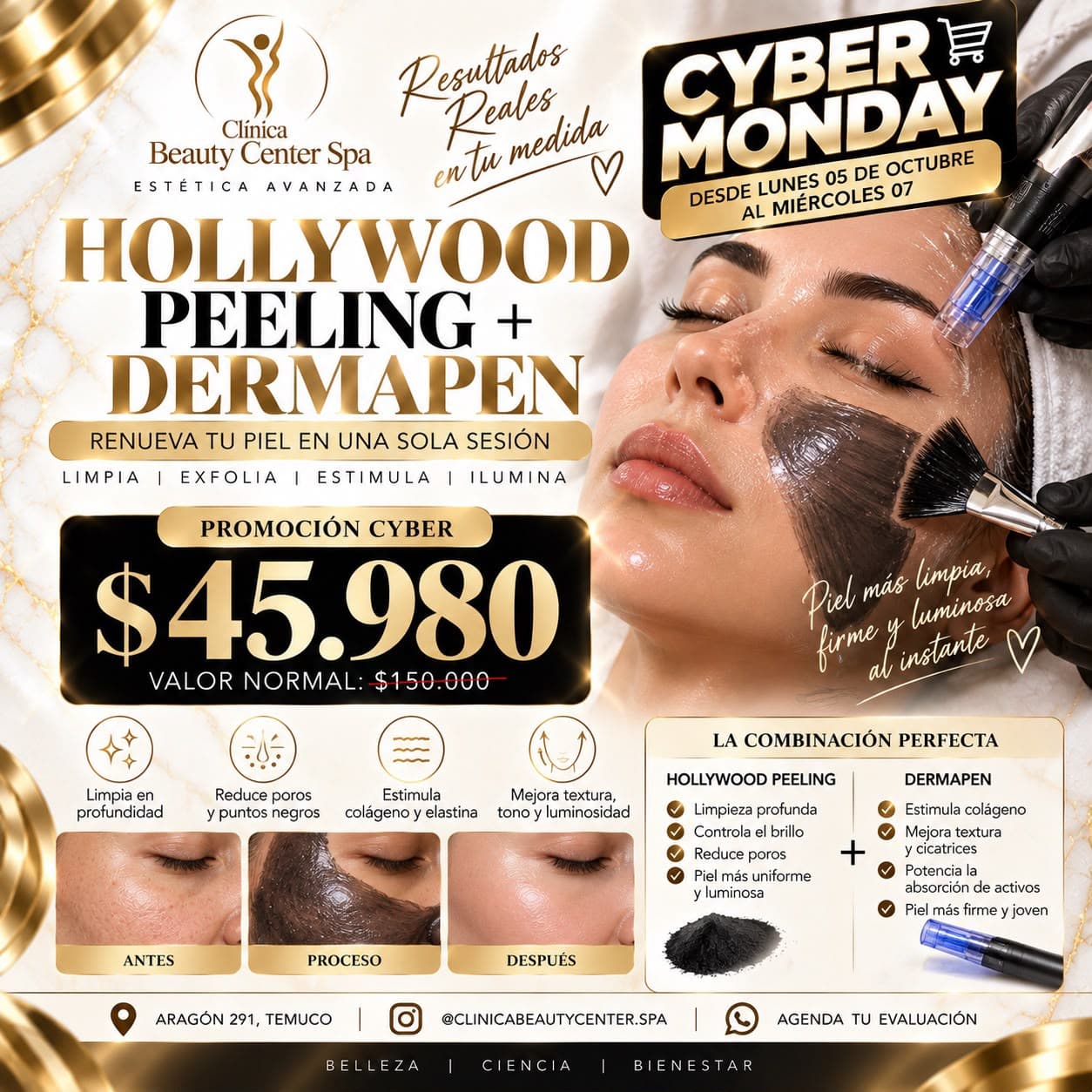 Promoción Cyber Hollywood Peeling más Dermapen a $45.980