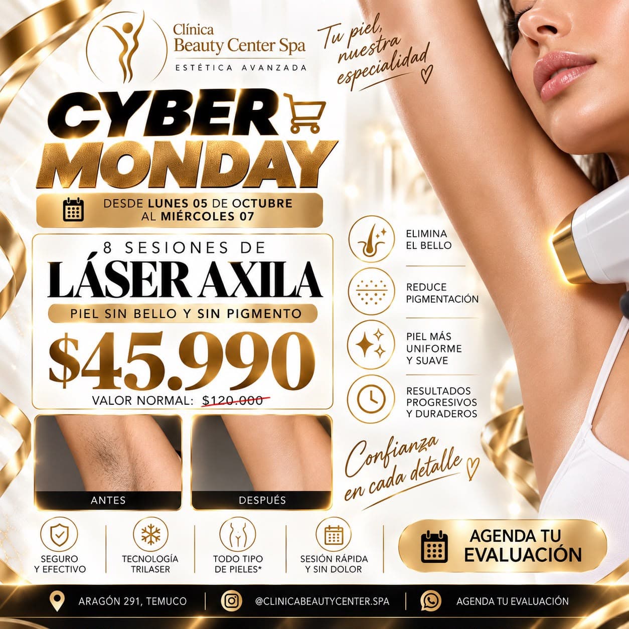 Promoción Cyber 8 sesiones de depilación láser axila a $45.990