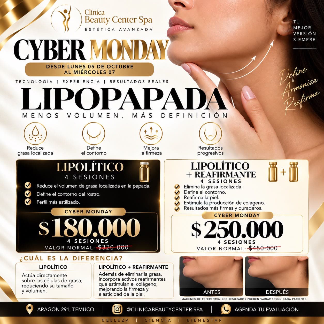 Promoción Cyber lipopapada: lipolítico o lipolítico más reafirmante, 4 sesiones