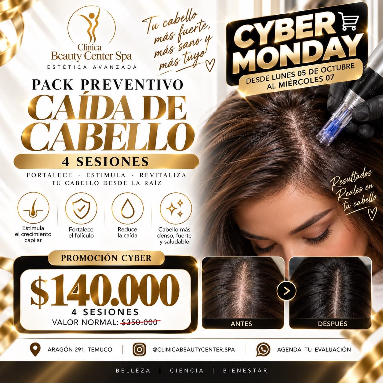 Promoción Cyber pack preventivo caída de cabello 4 sesiones a $140.000
