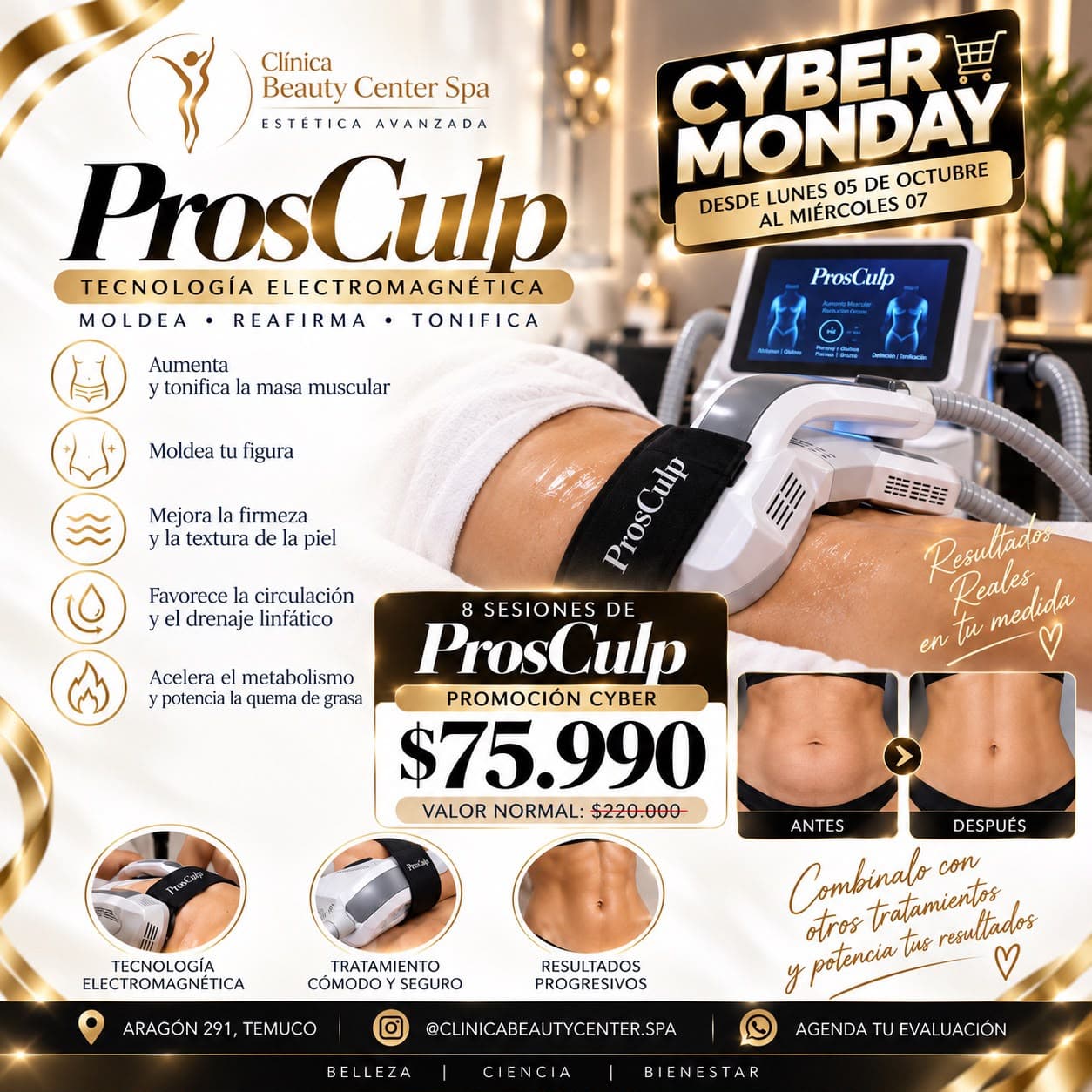 Promoción Cyber 8 sesiones de ProSculp a $75.990