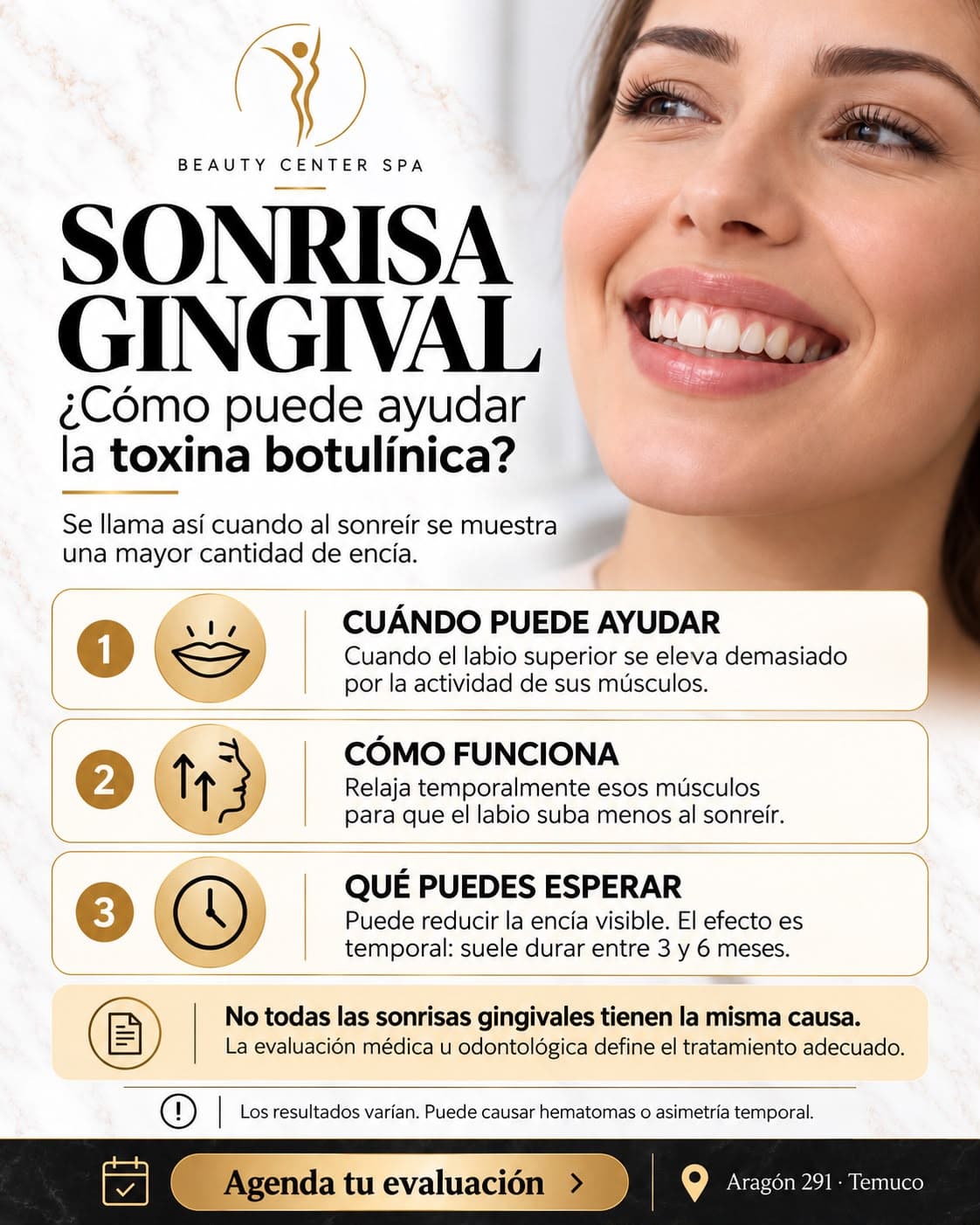 Infografía Sonrisa gingival: cómo puede ayudar la toxina botulínica, cuándo puede ayudar, cómo funciona y qué puedes esperar