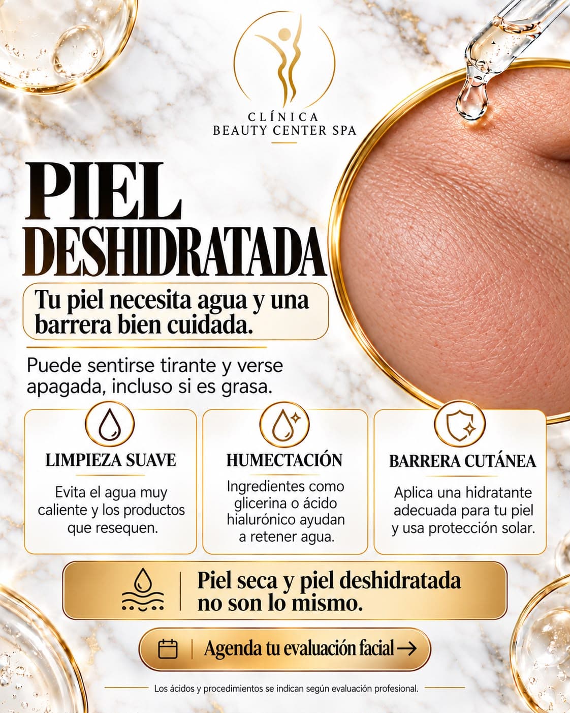 Infografía Piel deshidratada: tu piel necesita agua y una barrera bien cuidada