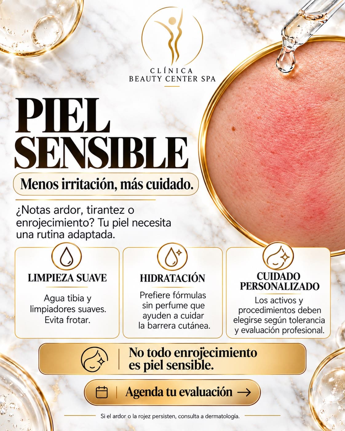 Infografía Piel sensible: menos irritación, más cuidado