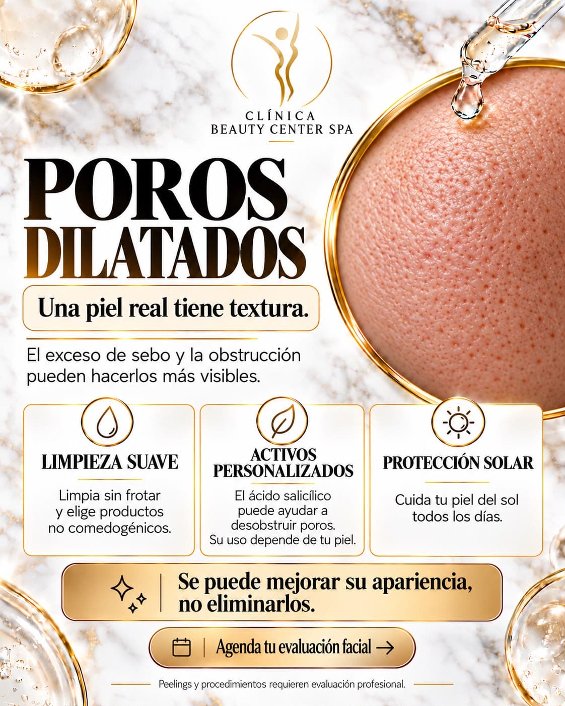 Infografía Poros dilatados: una piel real tiene textura