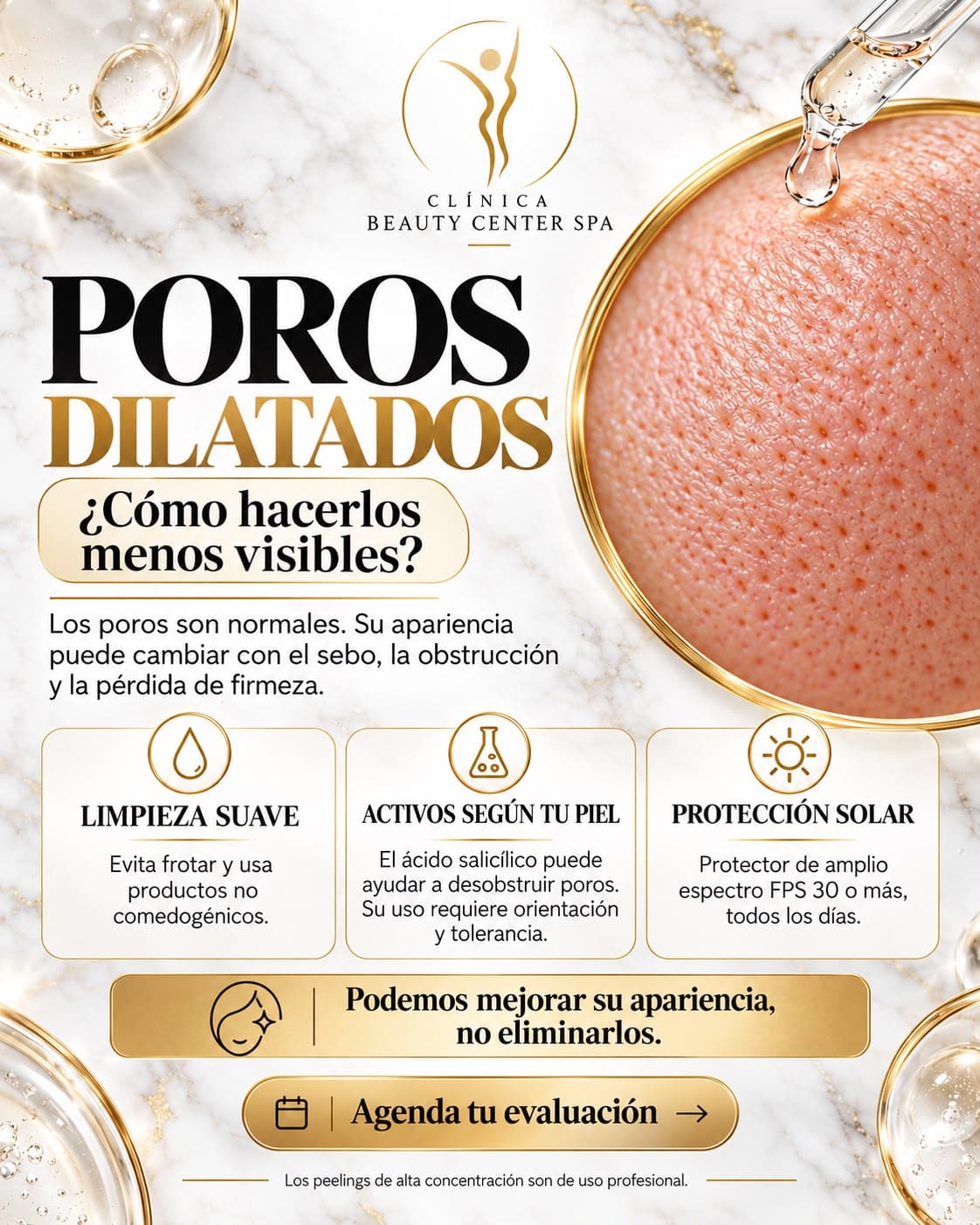 Infografía Poros dilatados: cómo hacerlos menos visibles