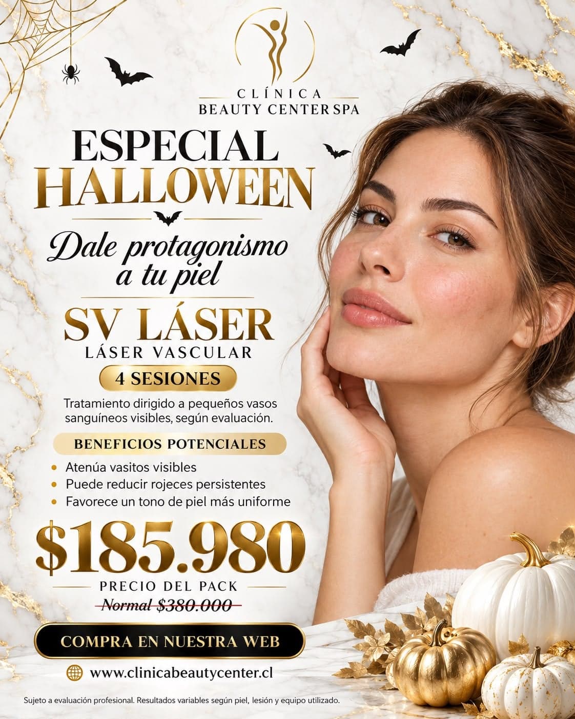 Especial Halloween: SV Láser vascular, pack de 4 sesiones $185.980, valor normal $380.000